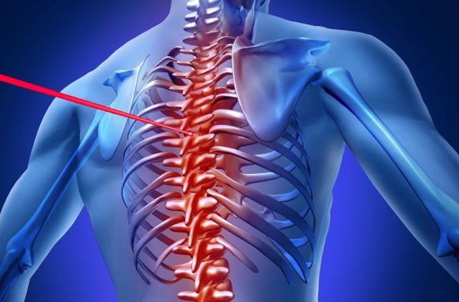Laser Spine Surgery in India